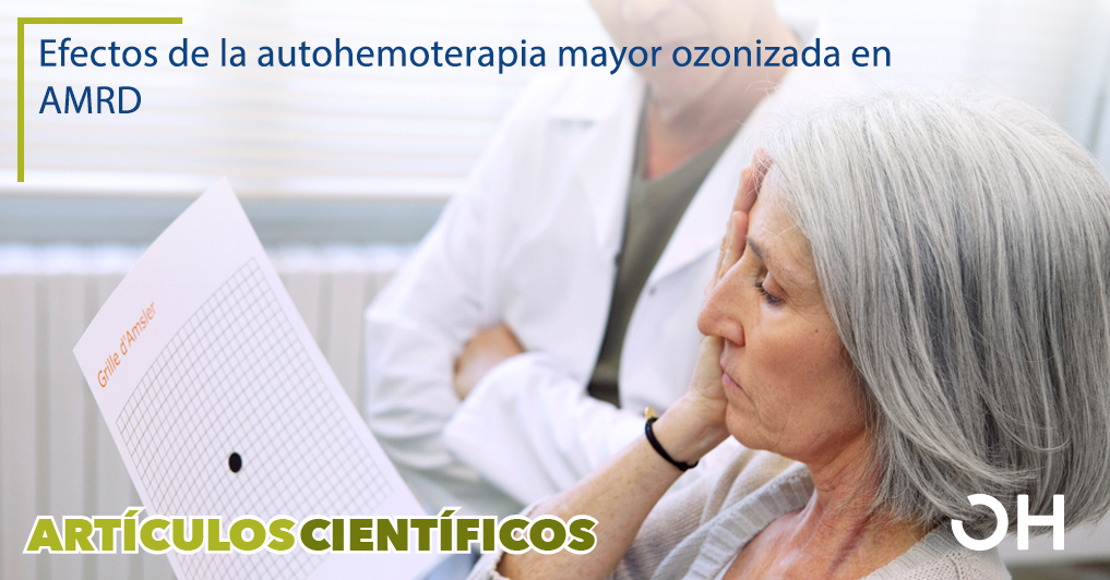 Mejora visual después de la ozonoterapia en la degeneración macular seca relacionada con la edad; una revisión