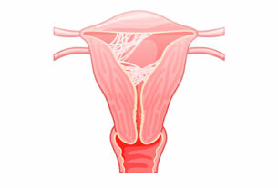 ozonoterapia peligros asherman