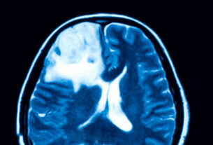 el ozono para que sirve isquemia reperfusion cerebral