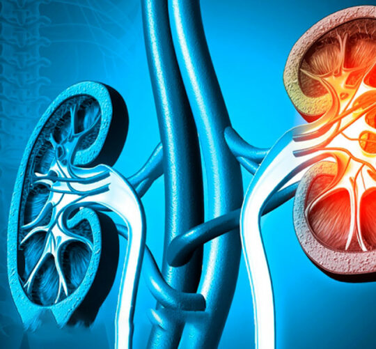 terapia de ozono renal enfermedad