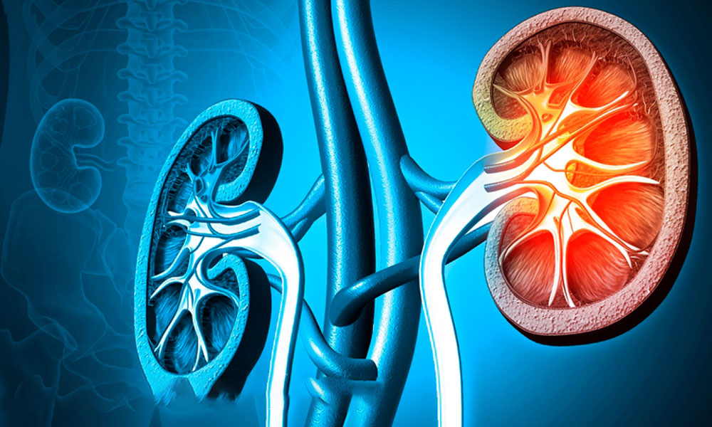 terapia de ozono renal enfermedad