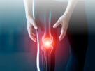 tratamiento para la artrosis de rodilla