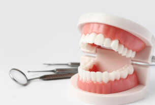 modelo de boca dental