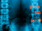 radiografias comparativas