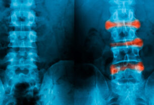 radiografias comparativas