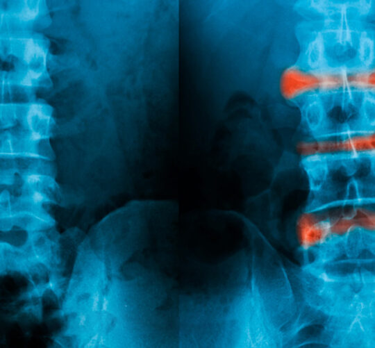 radiografias comparativas