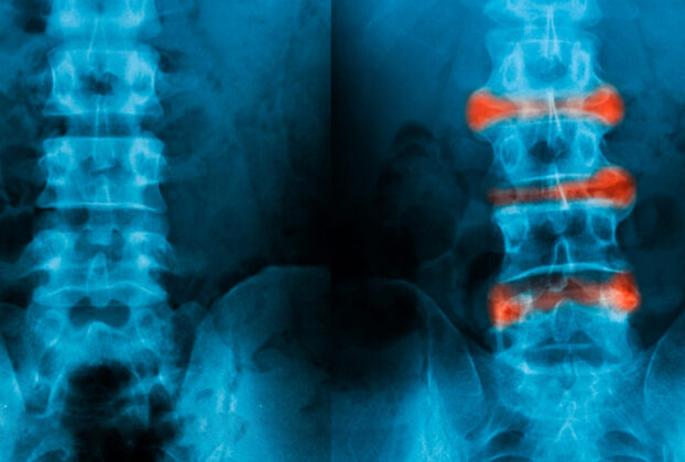 radiografias comparativas