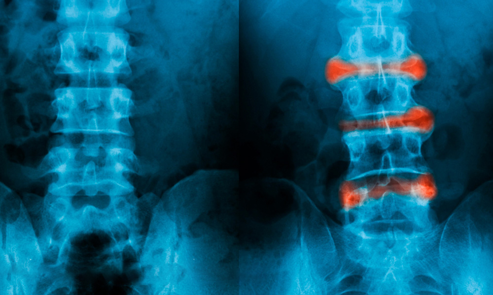 radiografias comparativas