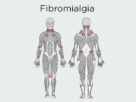 Esquema del cuerpo humano con zonas marcadas fibromialgia