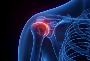 Radiografia en 3D del hombro