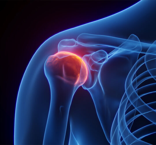 Radiografia en 3D del hombro