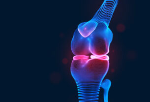 imagen 3d rodilla