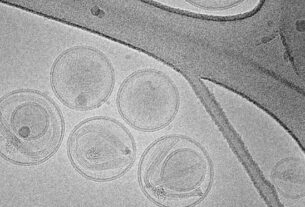 Imagen electrónica de nanopartículas