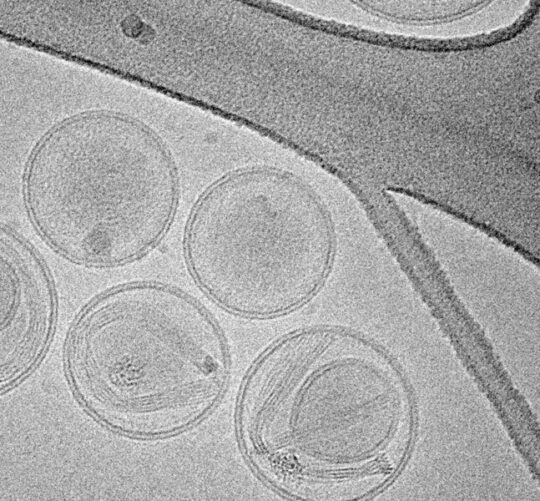 Imagen electrónica de nanopartículas