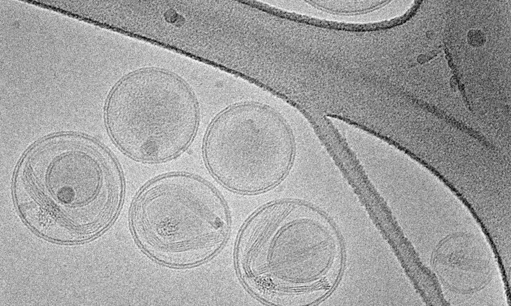 Imagen electrónica de nanopartículas