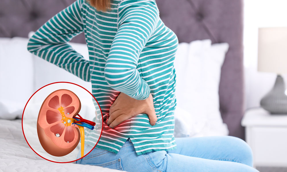 mujer sentada sobre la cama con dolor en los riñones