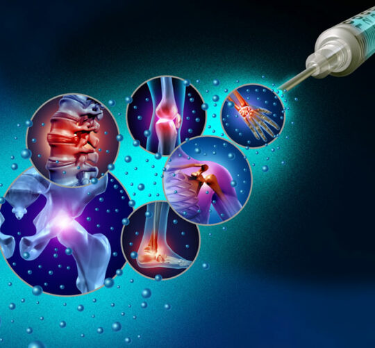 ilustracion en 3d Medicina Regenerativa del Dolor Articular