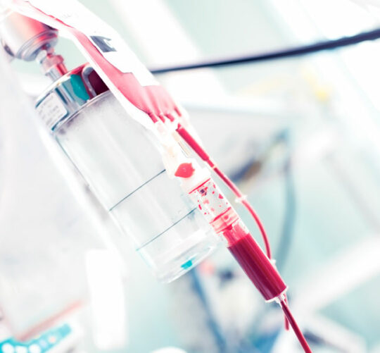 Bolsa de sangre durante la transfusión de sangre en el hospital