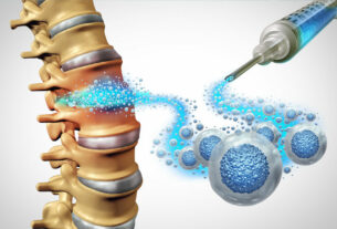 columna vertebral 3d nucleosis discal