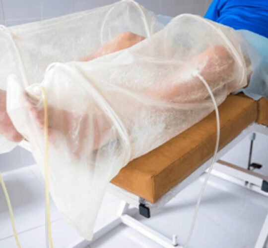 terapia de bolsa de campana en las piernas del paciente